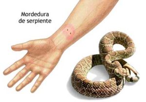 picadura